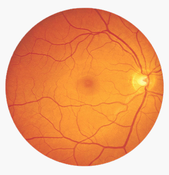 Retinal Imaging